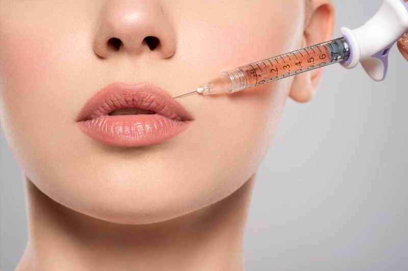 Preenchimento labial
