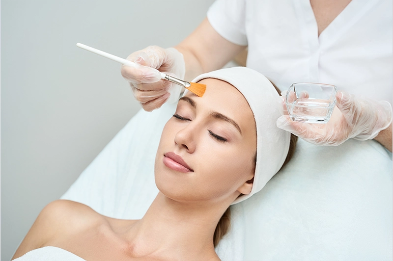 Peeling químico